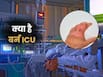 बर्न ICU क्या होता है? डॉक्टर बता रहे हैं गंभीर मरीजों का कैसे होता है इलाज