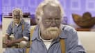What is Smurf syndrome? The rare disease that can turn your skin blue or grey