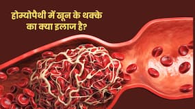 होम्योपैथी में खून के थक्के का इलाज क्या है? और कैसे किया जाता है?
