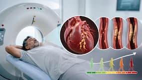 Coronary Artery Calcium Scan क्या है और ये आने वाले सालों में Heart Attack का खतरा कैसे बताता है?