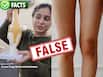 Fack Check: क्या किसी भी एक्सरसाइज से घुटनों के बीच का गैप कम हो सकता है?