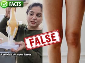 Fack Check: क्या किसी भी एक्सरसाइज से घुटनों के बीच का गैप कम हो सकता है?