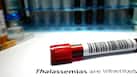 Low platelet count: Common causes of thrombocytopenia explained