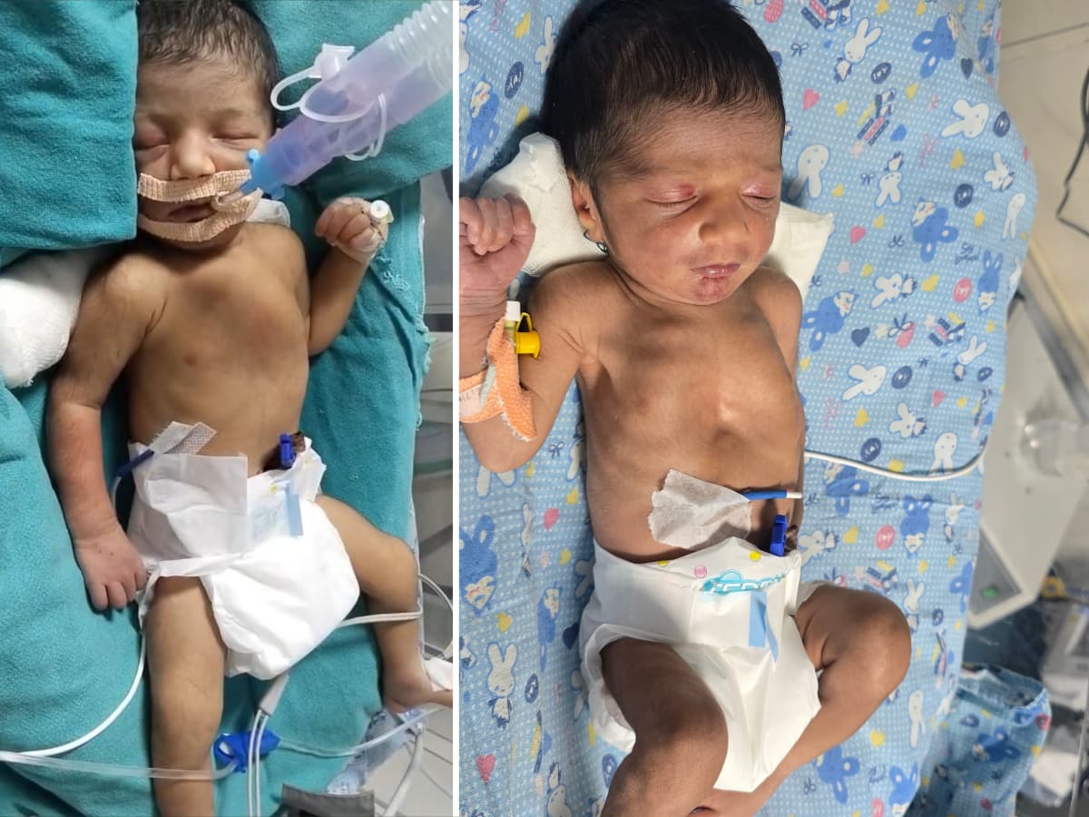 newborn baby in emergency care