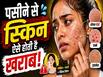 पसीने से स्किन कैसे होती है खराब? पिंपल्स, हीट रैश, फंगल इंफेक्शन से ये है बचाव का तरीका