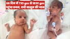 सिर्फ 730 ग्राम वजन के साथ हुआ जन्म, 66 दिन NICU में जिंदगी की जंग जीतकर घर लौटी बच्ची