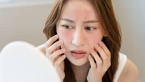 गर्मी में सेंसिटिव स्किन की केयर कैसे करनी चाहिए? जानें 5 टिप्स