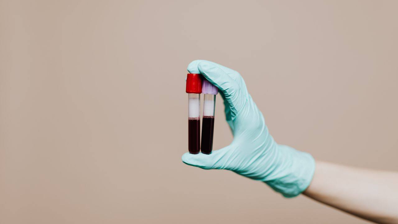 typhoid test