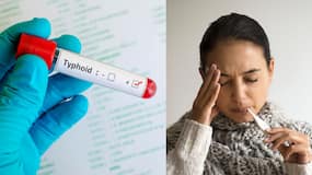 Typhoid Explainer: मानसून में क्यों बढ़ जाते हैं टाइफाइड बुखार के मामले? जानें क्या हैं इसके लक्षण, कारण और बचाव के उपाय