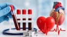 5 blood tests you should consider after turning 40 to know your heart disease risk