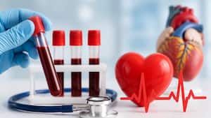 5 blood tests you should consider after turning 40 to know your heart disease risk