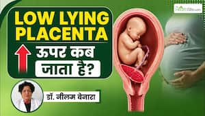 Low Lying Placenta कब तक ऊपर चला जाता है? जानें किस महीने तक ठीक हो जाता है