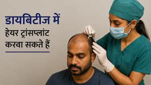 क्या डायबिटीज और हाई ब्लड प्रेशर के मरीज हेयर ट्रांसप्लांट करवा सकते हैं? जानिए डॉक्टर क्या कहते हैं