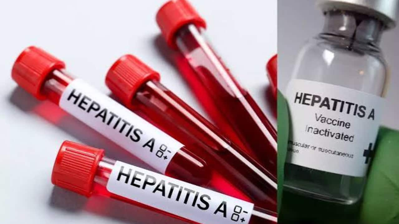 हेपेटाइटिस लिवर से जुड़ी बीमारी है।