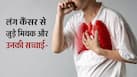 बिना स्मोकिंग किए भी हो सकता है Lung Cancer, डॉक्टर ने बताई इस बीमारी के मिथकों की सच्चाई