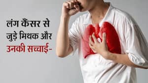 बिना स्मोकिंग किए भी हो सकता है Lung Cancer, डॉक्टर ने बताई इस बीमारी के मिथकों की सच्चाई