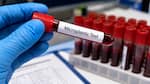 Microplastics found in blood of 84% of heart attack patients, study reveals