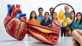 ICMR study reveals 9 in 10 Indian adults have abnormal cholesterol levels, raising heart disease risk
