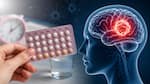 Popular hormonal contraceptive may raise risk of rare brain tumor: Study