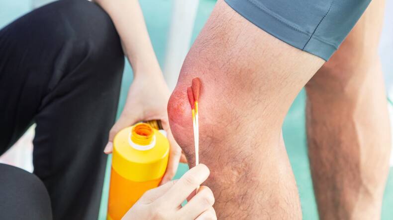8 warning signs of liver failure you should never ignore