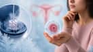 Egg freezing doesn't guarantee pregnancy: 7 important facts every woman should know