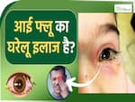 आई फ्लू से बचने के लिए ना अपनाएं ये घरेलू नुस्खे! इन लोगों को है ज्यादा खतरा!
