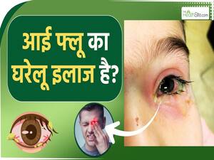 आई फ्लू से बचने के लिए ना अपनाएं ये घरेलू नुस्खे! इन लोगों को है ज्यादा खतरा!