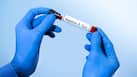 World Hepatitis Day 2026: Vaccines exist, treatments work so why are hepatitis B and C still deadly?