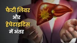 फैटी लिवर VS हेपेटाइटिस: जानें दोनों में क्या अंतर है? कब लें डॉक्टर की सलाह