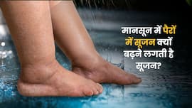 मानसून में पैरों में सूजन क्यों बढ़ सकती है? ये हो सकती हैं वजहें