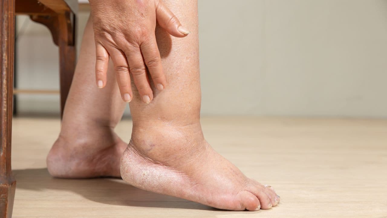 Feet Swellon