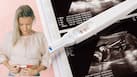 Fertility tests for women: Should I check my AMH levels even if I'm unmarried? Expert explains
