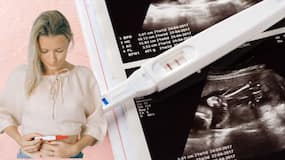 Fertility tests for women: Should I check my AMH levels even if I'm unmarried? Expert explains