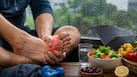 Uric acid control tips: 5 monsoon habits that can help prevent gout
