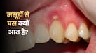 दांतों के मसूड़ों से मवाद आने के क्या हैं कारण? जानें किन बीमारियों का हो सकता है संकेत