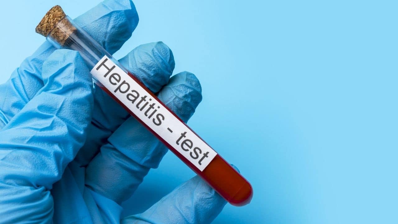 Hepatitis