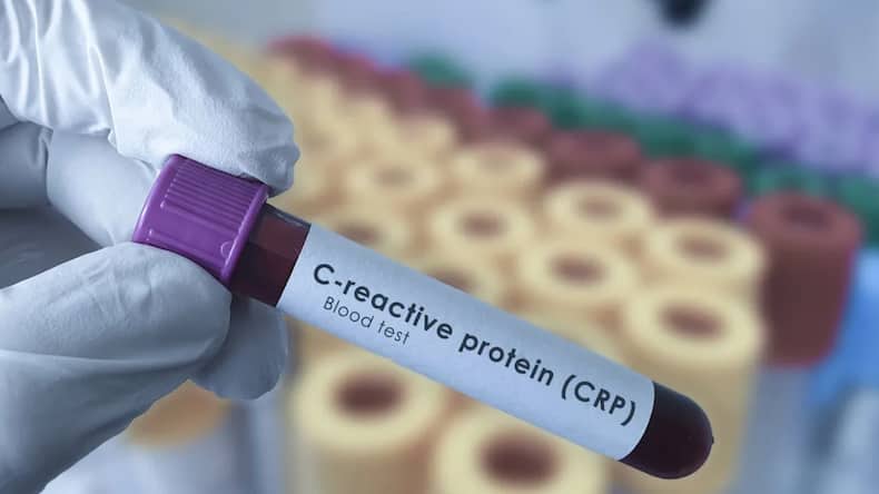 5 blood tests you should consider after turning 40 to know your heart disease risk