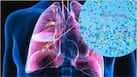 How much microplastic are you breathing every day? What studies reveal about the hidden health risks
