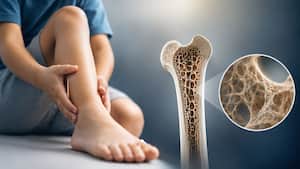 Hypophosphatasia explained: The rare genetic condition that leaves bones too weak to harden