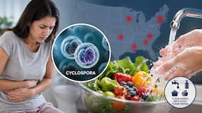 Cyclospora outbreak: Health officials advise prevention tips as    explosive diarrhoea    parasite surges in US