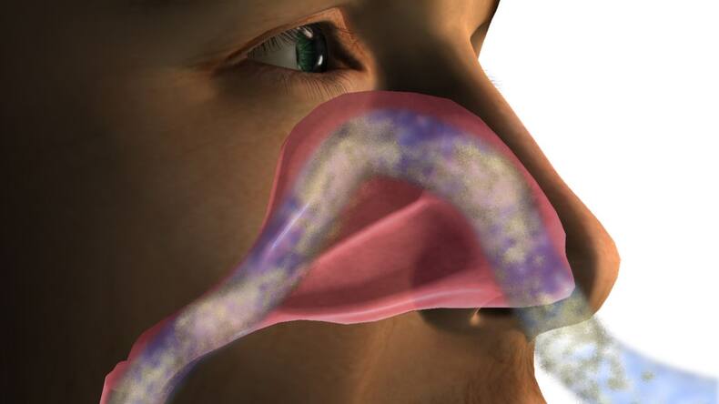 No more stuffy nose: 5 smart ways to prevent sinus issues