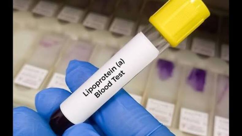 5 blood tests you should consider after turning 40 to know your heart disease risk