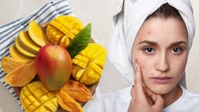 Does eating mangoes cause pimples and body heat? Separating facts from fiction