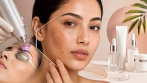 Melasma treatment has changed: Dermatologist explains the latest creams, lasers and therapies that actually work