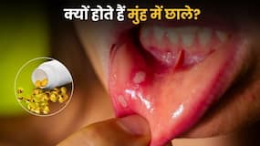 बार-बार मुंह में छाले होना किन विटामिन की कमी का संकेत हो सकता है?