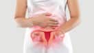 Nearly 70% of women with PCOS have insulin resistance: What your gut may have to do with it