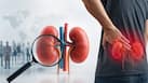 Nearly half of 844 million chronic kidney disease cases go undiagnosed worldwide: Early warning signs and who is most at risk