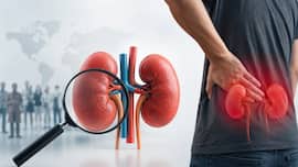 Nearly half of 844 million chronic kidney disease cases go undiagnosed worldwide: Early warning signs and who is most at risk