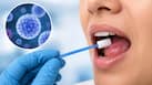 New one-hour brush test may detect oral cancer without painful biopsy, study finds