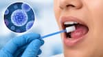 New one-hour brush test may detect oral cancer without painful biopsy, study finds